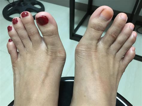 Yes or No? | Scrolller