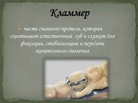 Кламмерная фиксация. Виды кламмеров. Конструирование бюгельного протеза ...