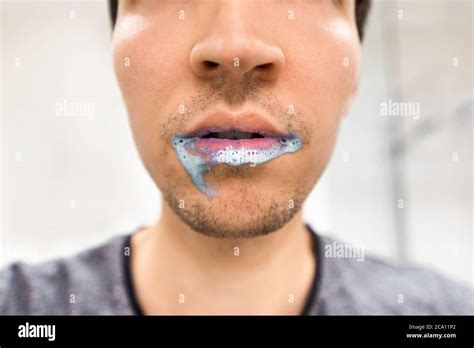 human foaming   mouth