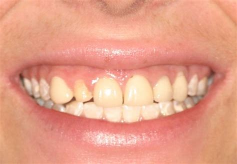 cosmetic dentistry
