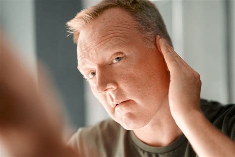 actinic control md spf  prevents actinic keratosis