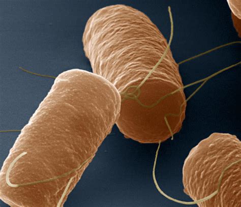 bacillus cereus food poisoning  foodborne toxins  biology