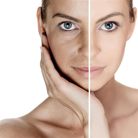 prp-facelift - American Regenerative Clinic