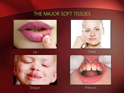 soft tissue morphology pptx