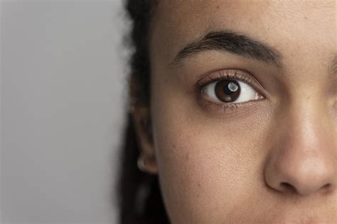 Dark Circles Under Eyes : 8 Causes and Prevention | Credihealth