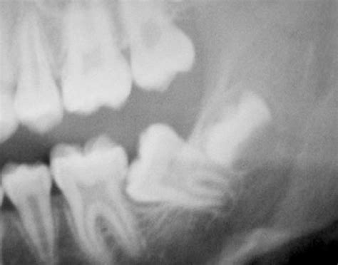 Cirugia Bucal | Odontologists