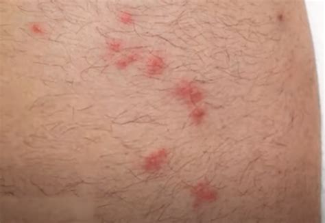 how to know if you have fleas in your home