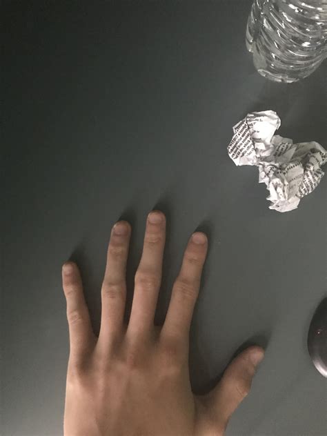 Why do my fingers look like this?? They didn’t use to look so weird