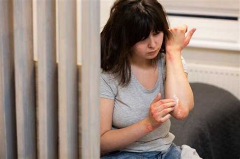 Чешутся ноги ниже колен у женщин: причины, лечение