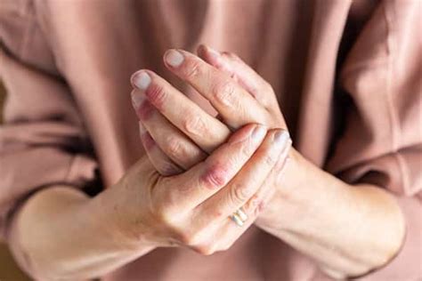 Hand Exercises To Ease Joint Pain - RecreationTime.net