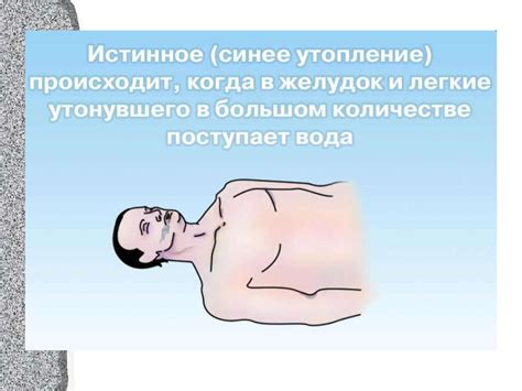 Утопление. Виды утопления. Первая медицинская помощь - презентация онлайн