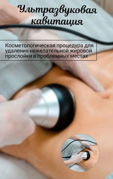 КАВИТАЦИЯ МИНУС 2-4 САНТИМЕТРА ЗА ОДНУ ПРОЦЕДУРУ! Коррекция фигуры ...