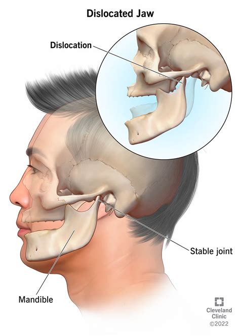 Jaw Socket Diagram