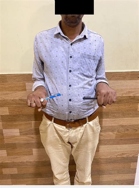 Clinical photograph showing pronation movement at the elbow joint ...