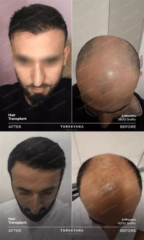 medical tourism visit istanbul