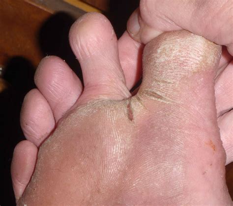 A friendly reminder to put lotion on your feet | Cakewalk Forums