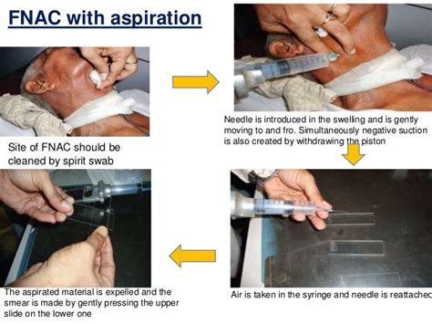 FINE NEEDLE ASPIRATION CYTOLOGY / FNAC