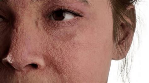 render collagen pushing sagging skin stock footage video