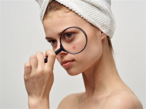 deretan produk  bisa diandalkan  mengatasi jerawat