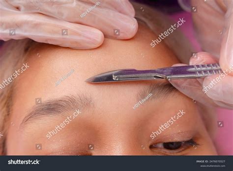 Close-up Dermaplaning Procedure Exfoliating Skin Removing Stock Photo