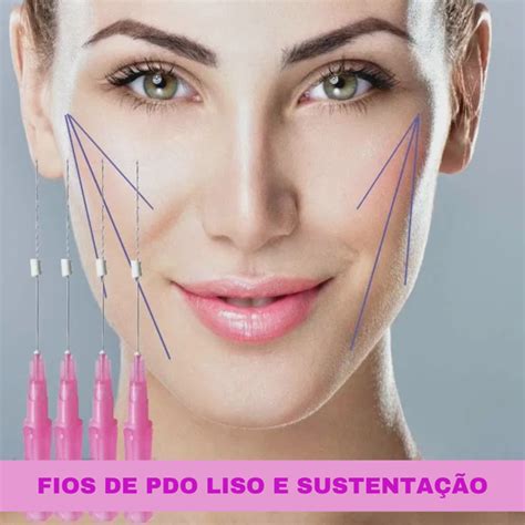 Fios De Pdo Prós E Contras - FIOS DE PDO - LISO E SUSTENTAÇÃO - Spazzio