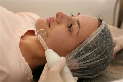 Clear Skin Ahead: The Ultimate Guide to Acne Scar Removal