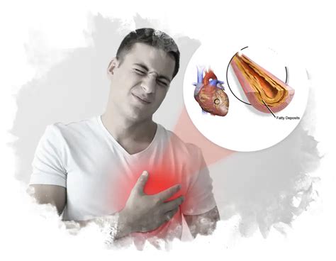 coronary artery disease durja ayurveda