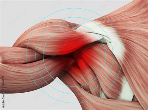 human anatomy muscle shoulder pain  injury  illustration stock