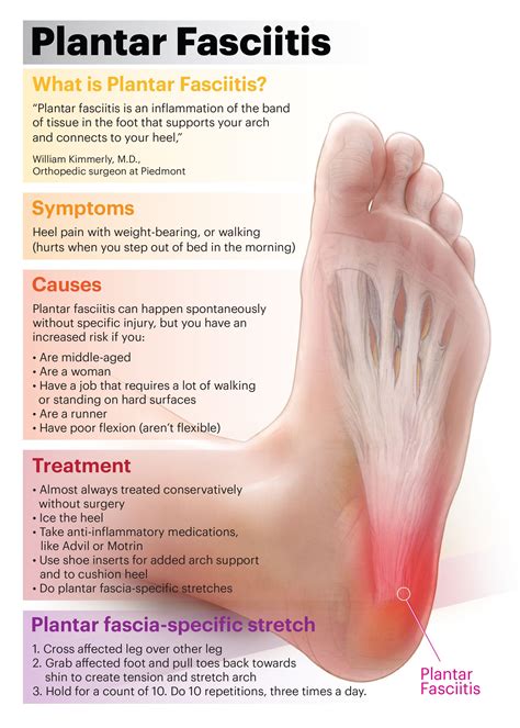 Plantar fasciitis rehabilitation exercises – Artofit