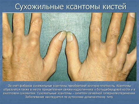 Дифференциальная диагностика высыпаний на лице - презентация онлайн