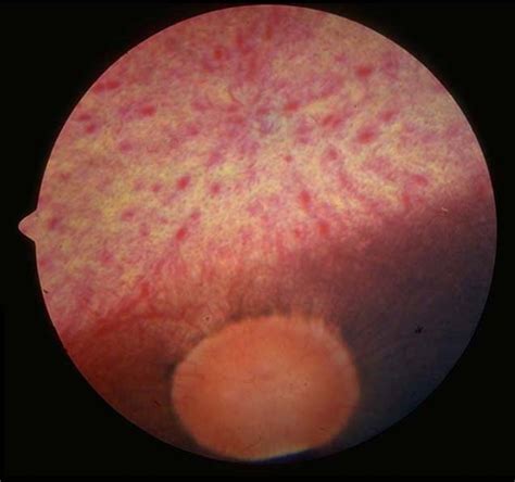 fundus normal  welsh pony  year   horses equis vetlexicon