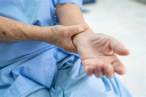 Wrist Arthritis Treatment in Singapore | Advanced Hand Centre