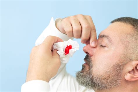 Does Nose Bleeding Break Wudu? | About Islam