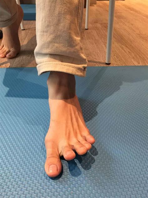 5 Most Useful Exercises for Treating Flat Feet - Your Physio