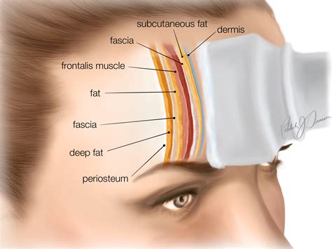 Academy anatomy forehead - Cutaneous
