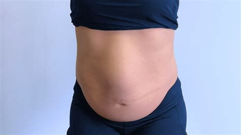 Abdômen Distendido O Que É - 11 Causas de Barriga Inchada (abdômen distendido)