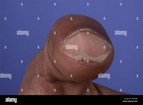 bifid  res stock photography  images alamy