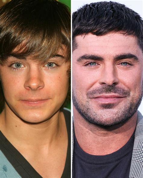 Zac Efron Before and After: From 2004 to 2024