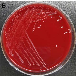 Colonies and microscopic morphology of Peptoniphilus asaccharolyticus.... | Download Scientific ...