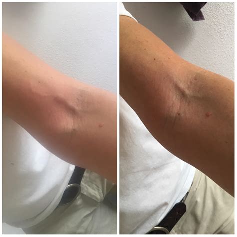 WTF I hate my left arm! Another missed shot post. Would you mind taking