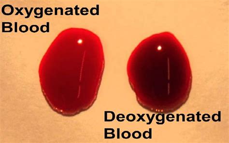 Detection Of Abnormal Hemoglobin Variants By HPLC Method:, 54% OFF