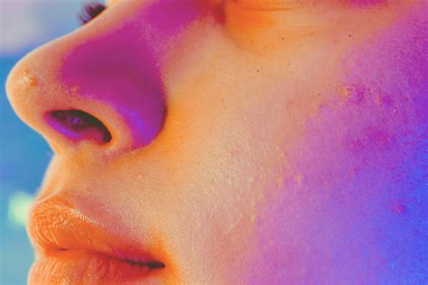 types  face bumps  questions answered