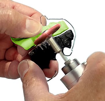 compressed abrasive buff summit orthodontic services