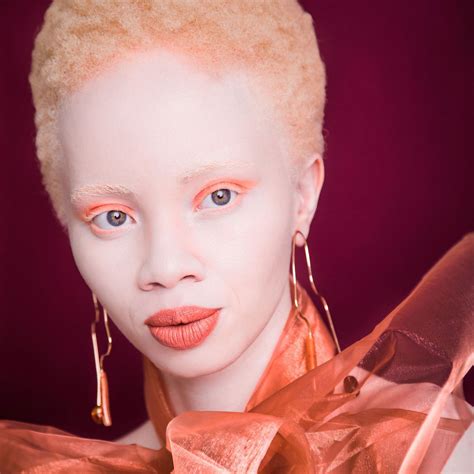 albino people race