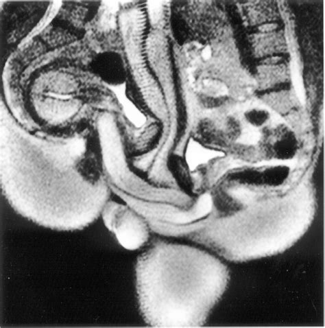 Magnetic resonance imaging MRI showing sexual intercourse | Wellcome