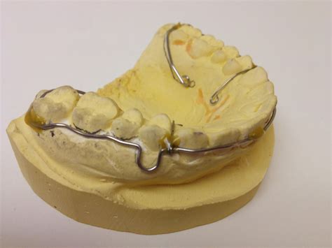 wraparound – Retainer Designer | Designer Retainer