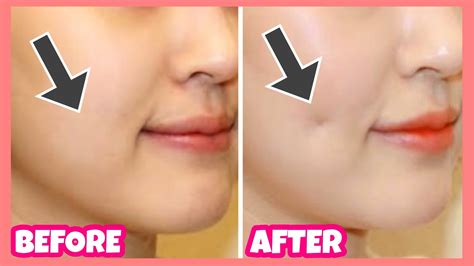 Create Dimples Fast and Naturally! Dimples Exercises & Massage - YouTube
