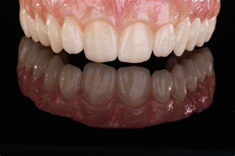 Denture Repair | Harmony Dental Lab