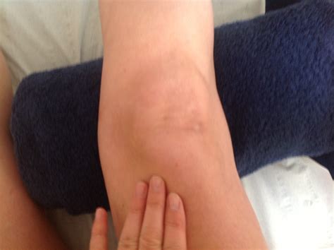 Knee Pain and Possible Treatments - The Therapy Rooms Newcastle