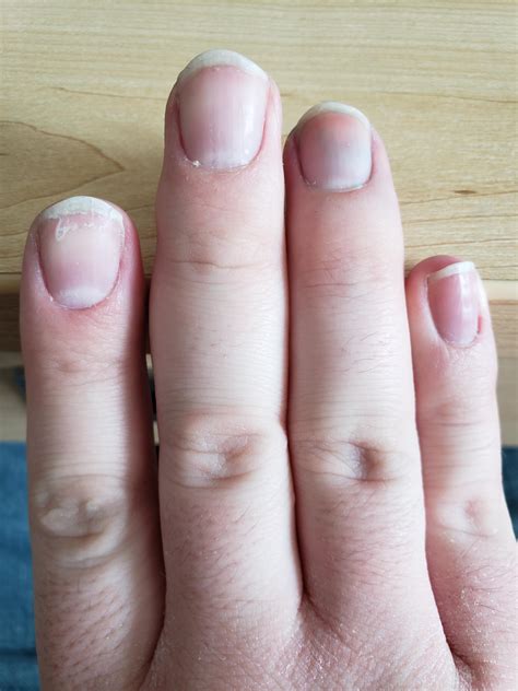 Should I let my nails heal before I paint them again? If so, how long